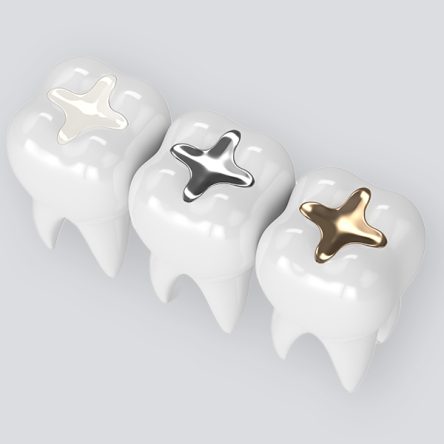 Dental Filling