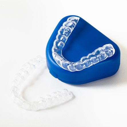 How Dentists Track Your Smile Progress with Invisalign