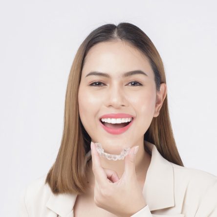 Start Your Smile Journey: Get a Free iTero Scan with Your Invisalign Consultation!