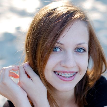 How Orthodontics Benefits Adults: Exploring Treatment Options for a Perfect Smile